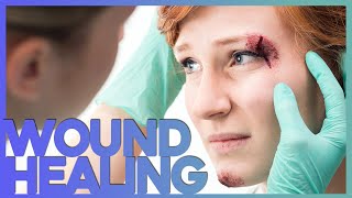 Face-wound porady wskazówki